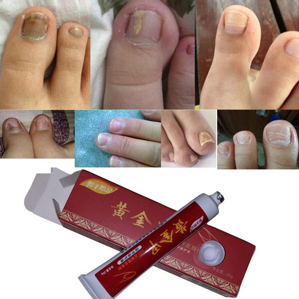 Yishou Yizu Golden Nail Care Cream 20g
