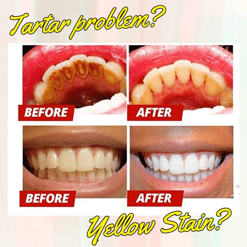 WE2C Whitening Toothpaste Teeth Cleaning Toothpaste Remove Plaque Remove Stains Oral Ordor Cleaning Bright Teeth Breath, Jasmine, Mint Gum Protection Foam Foaming SP5 Cleansing