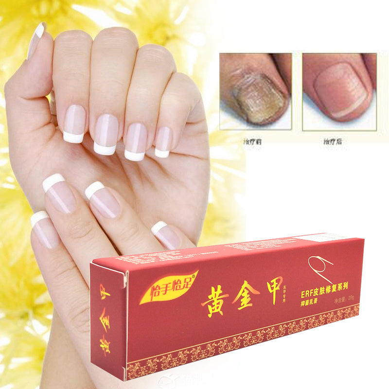 Yishou Yizu Golden Nail Care Cream 20g