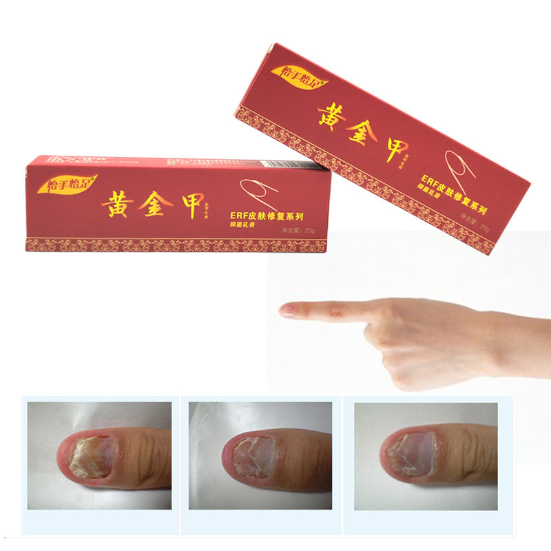 Yishou Yizu Golden Nail Care Cream 20g