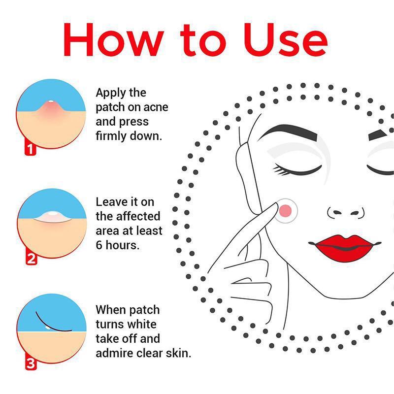 Waterproof Water Gel Acne Patch To Reduce Acne Marks