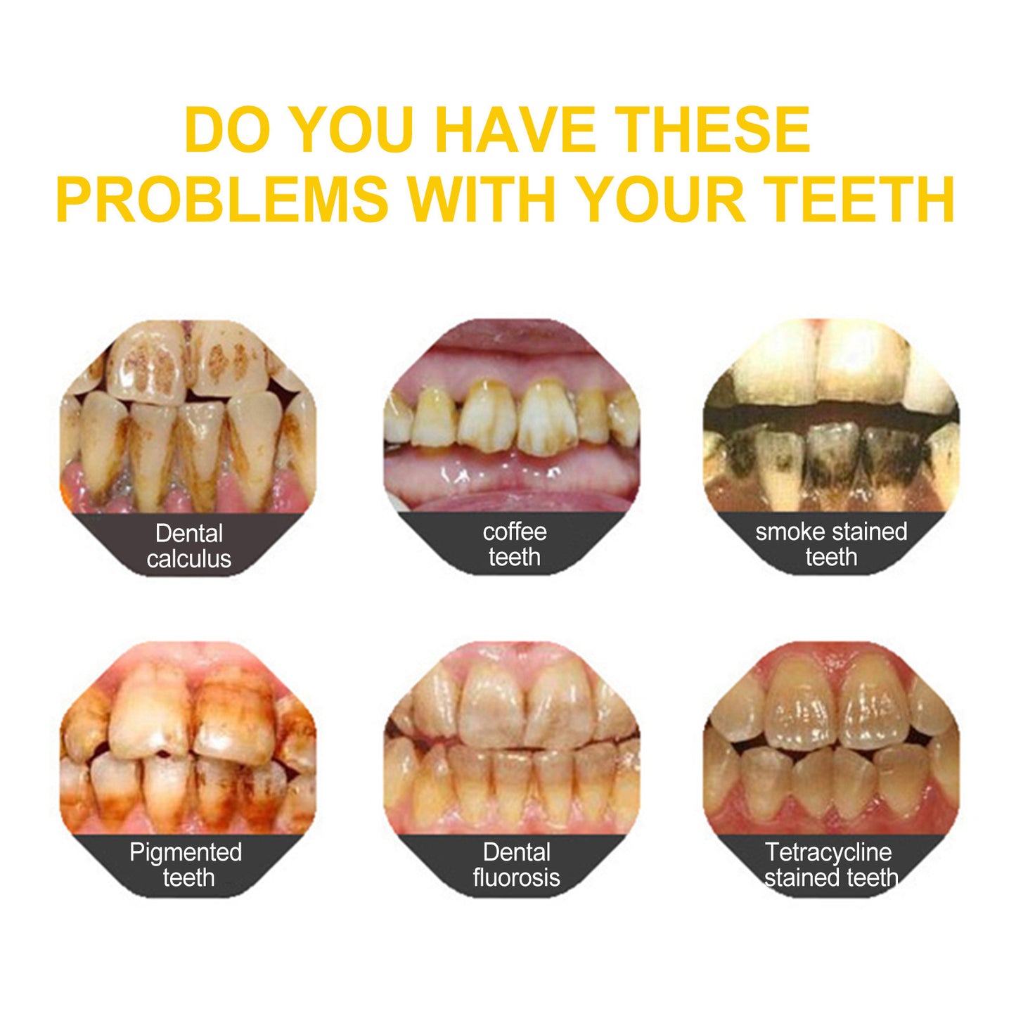 Gingival Care To Clean Tooth Stains