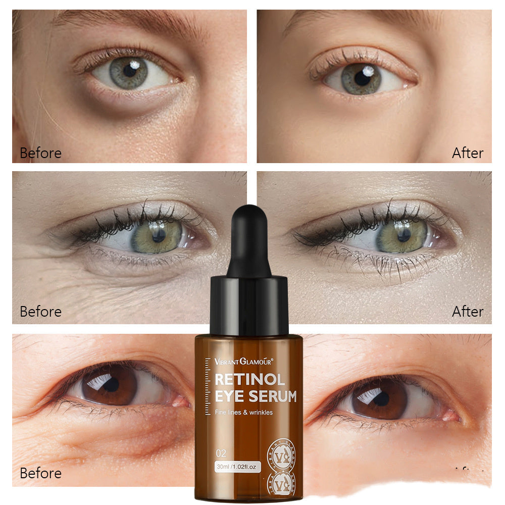 Reduce Fine Lines Around The Eyes Moisturize