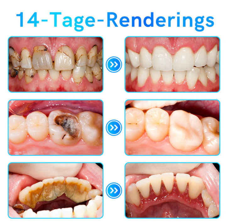Foaming Dental Cleansing And Care Toothpaste